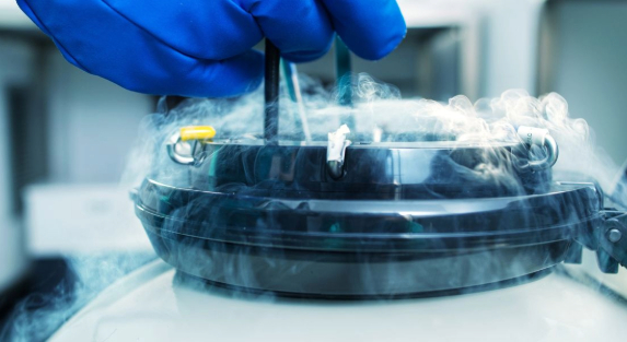 What Are the Best Practices for Cryogenic Handling